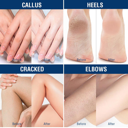 Intensive Moisturizing Foot Cream for Dry Skin