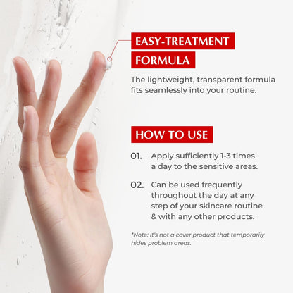 Fast Acting Acne Spot Treatment Cream