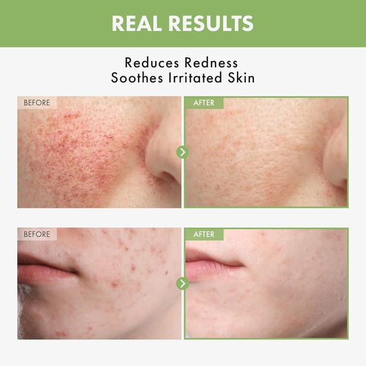 Gentle Soothing Face Toner 250ml