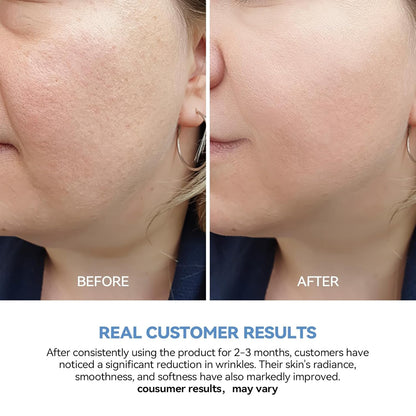 Intensive Hydrating Serum 30 x 1.2ml Hyaluronic Acid Moisturizer