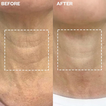 Smooth Neck Wrinkle Stickers - Reusable Silicone Patches