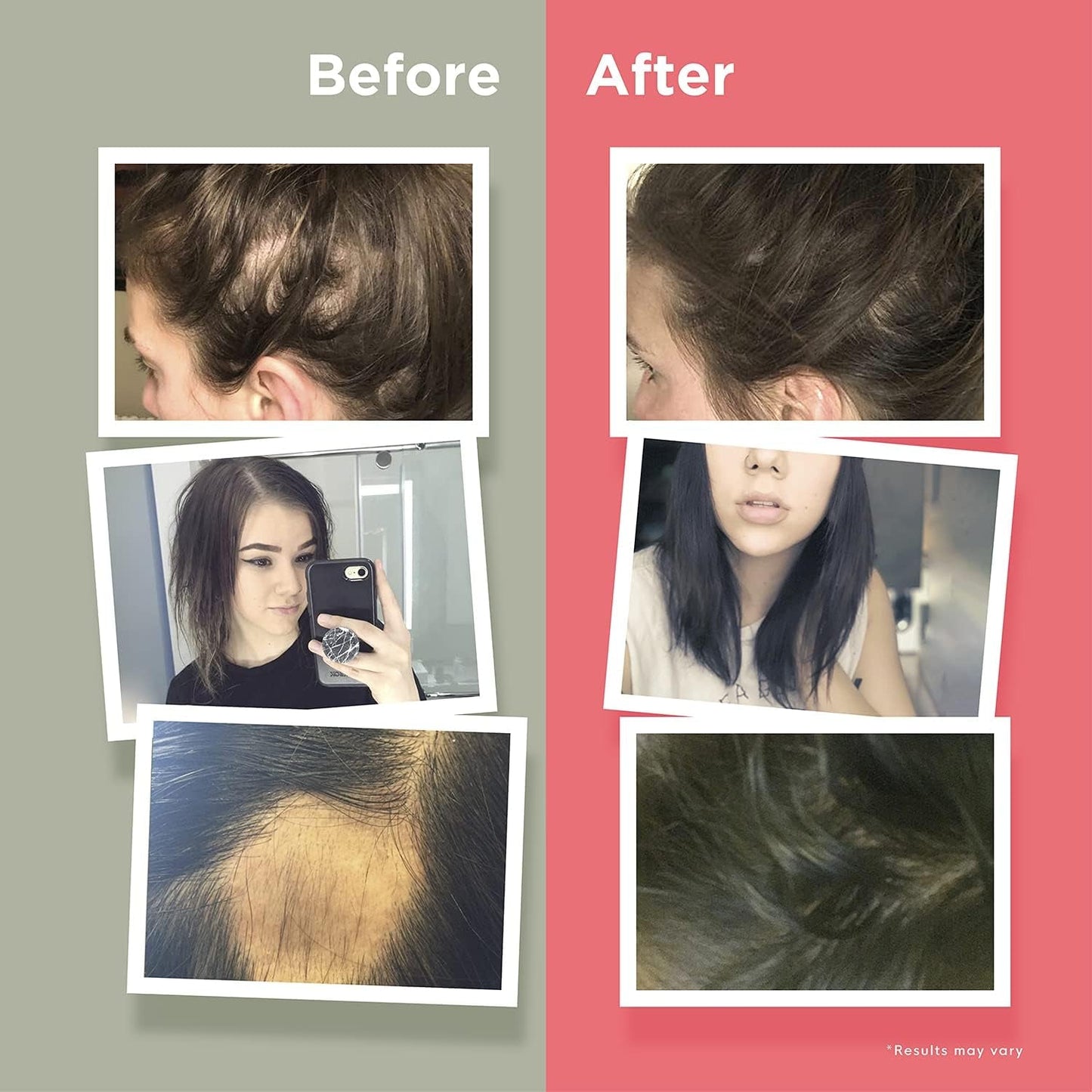 Premium Biotin Hair Growth Vitamins - 60 Capsules