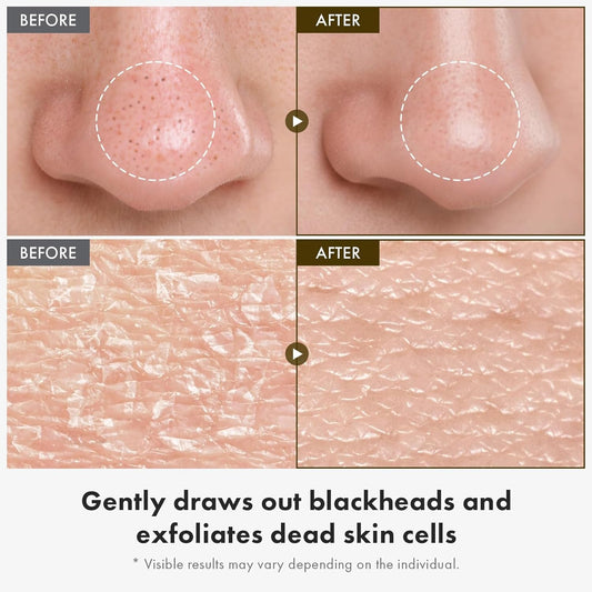 Natural Rice Facial Serum 85ml - Skin Brightening Toner