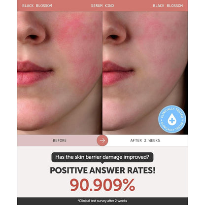 Nourishing Black Tulip Face Serum