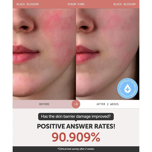 Nourishing Black Tulip Face Serum