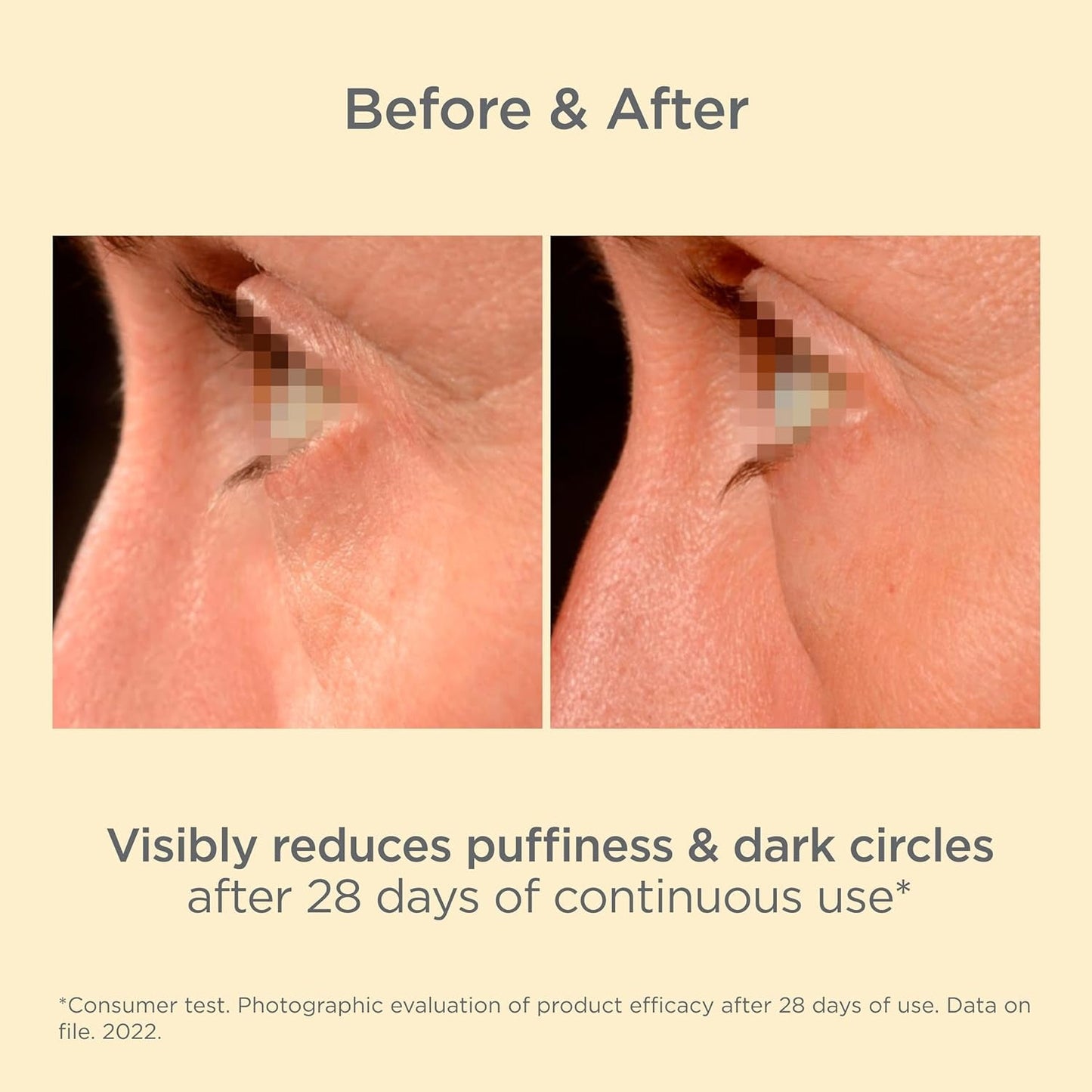 Anti Aging Eye Cream - Dark Circles & Puffiness Reducer