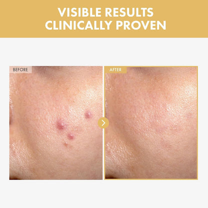 Intensive Hydrating Snail Serum 30ml Brightening Glow Treatment