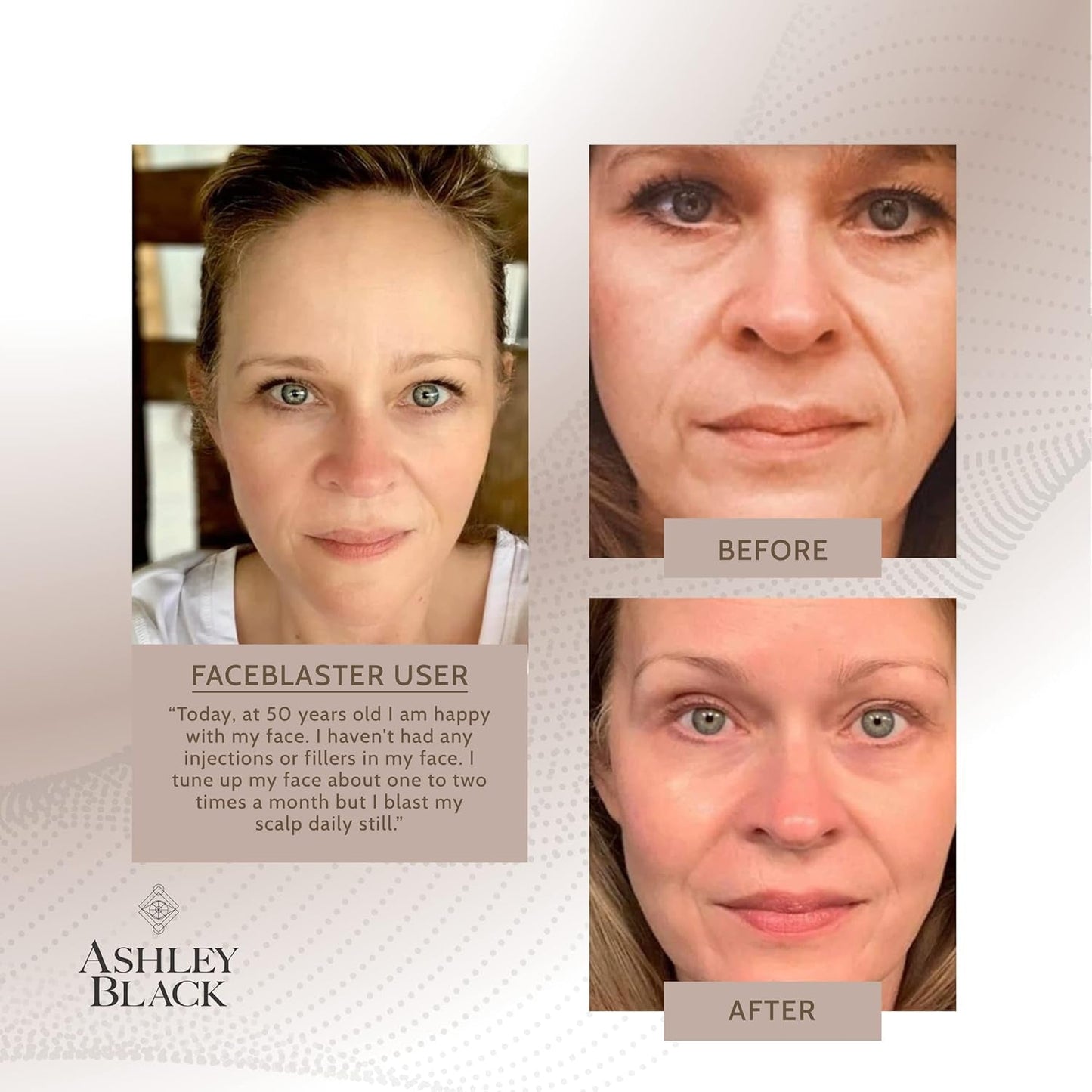Facial Massage Tool for Skin Tightening and Collagen Boost