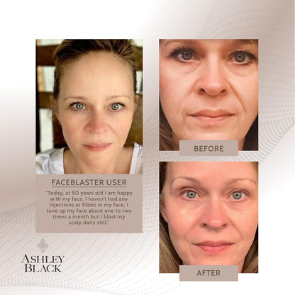 Facial Massage Tool for Skin Tightening and Collagen Boost