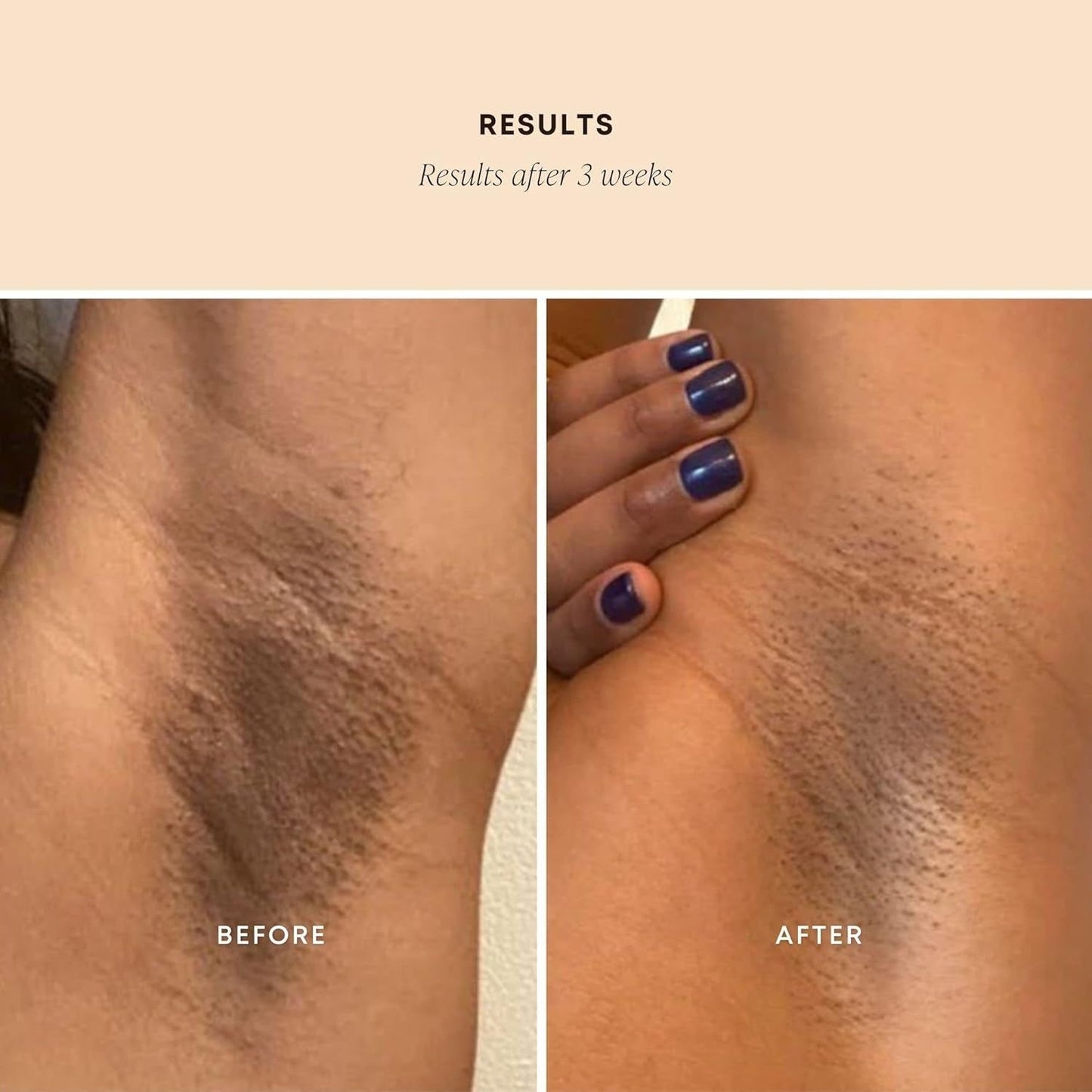 Natural Exfoliating Face Scrub for Brighter Skin