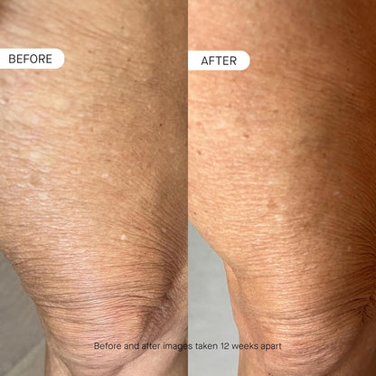 Anti Aging Body Moisturizer with Peptides & Ceramides