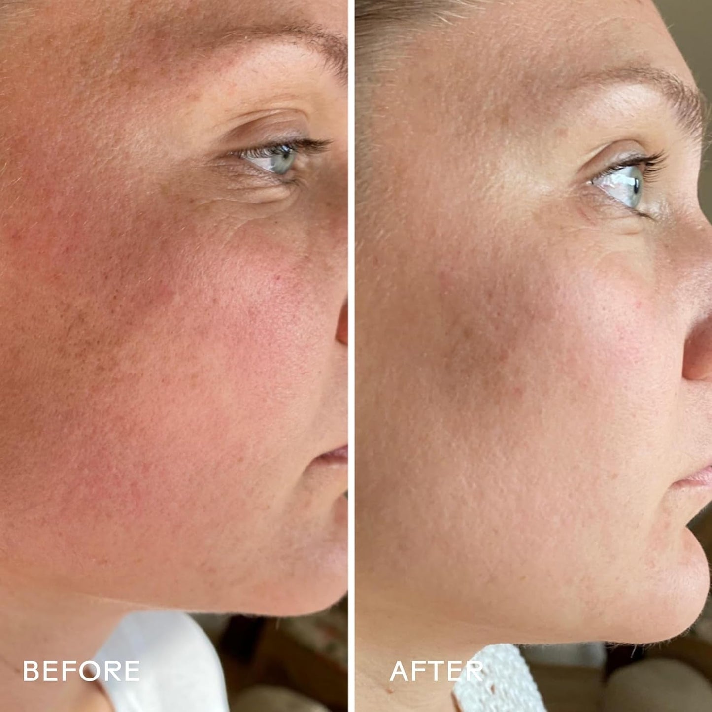 Natural Anti Aging Face Serum 30ml - Wrinkle Reducer