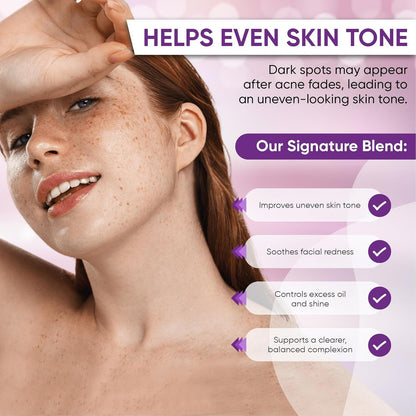 Natural Acne & Redness Relief Face Serum 30ml