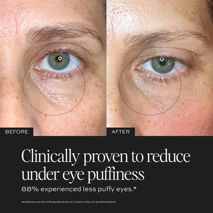 Anti Aging Eye Cream - Reduce Dark Circles & Wrinkles