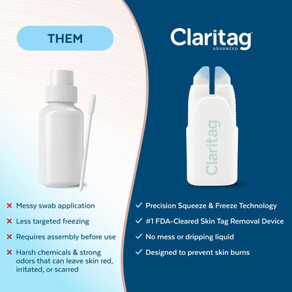 Easy At-Home Skin Tag Removal Device