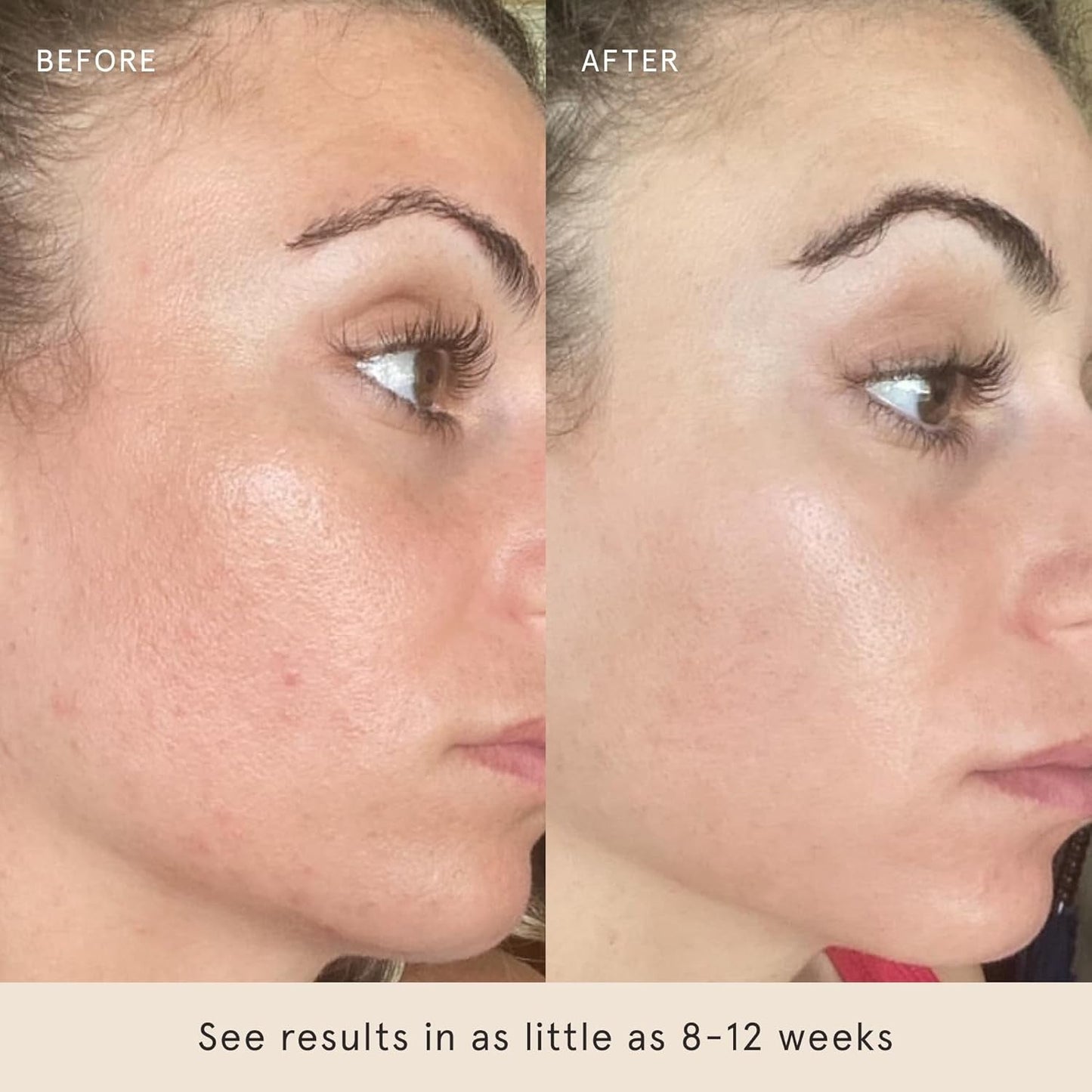 Glowing Skin Toner Pads 60 Pack - Exfoliates Minimizes Pores