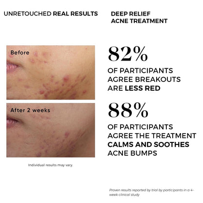 Effective Acne Treatment Pads with Salicylic Acid