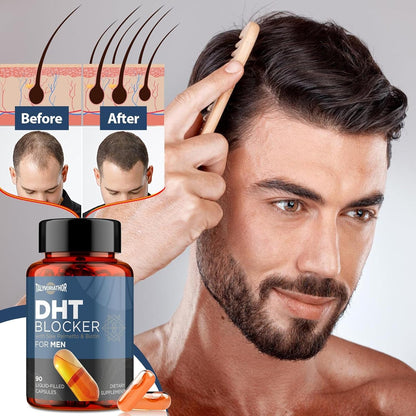 Natural Hair Growth Supplement for Men - 90 Capsules
