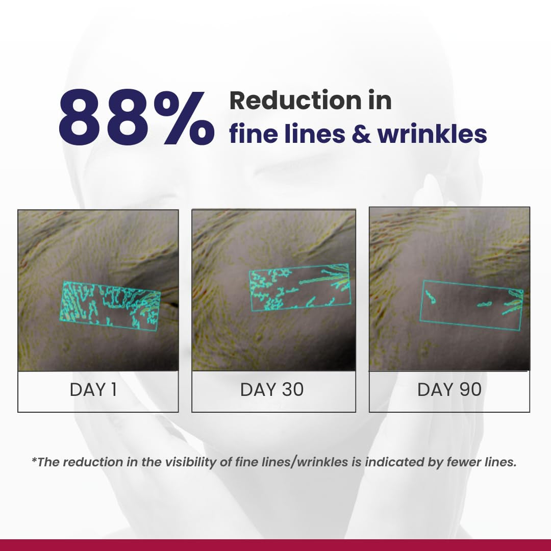Anti Aging Retinol Night Moisturizer Cream