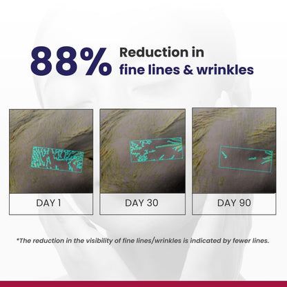Anti Aging Retinol Night Moisturizer Cream
