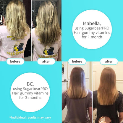 Strong Hair Growth Gummies with 6000mcg Biotin