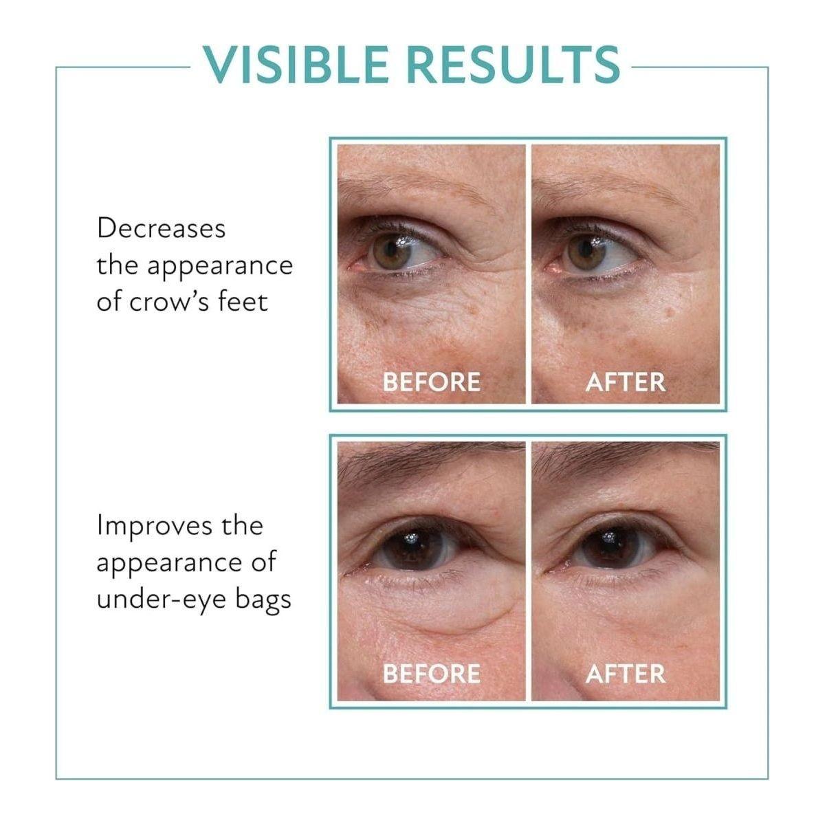 Quick Fix Under Eye Firming Gel 10ml