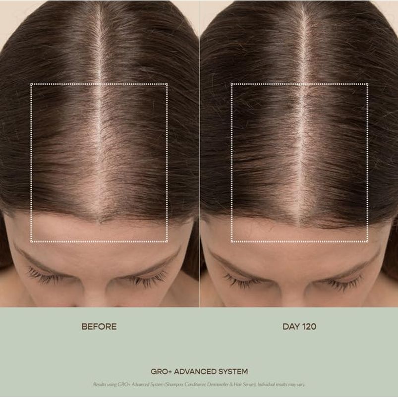Nourishing Hair Growth Serum for Thick Full Hair