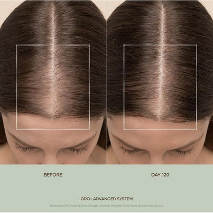 Nourishing Hair Growth Serum for Thick Full Hair
