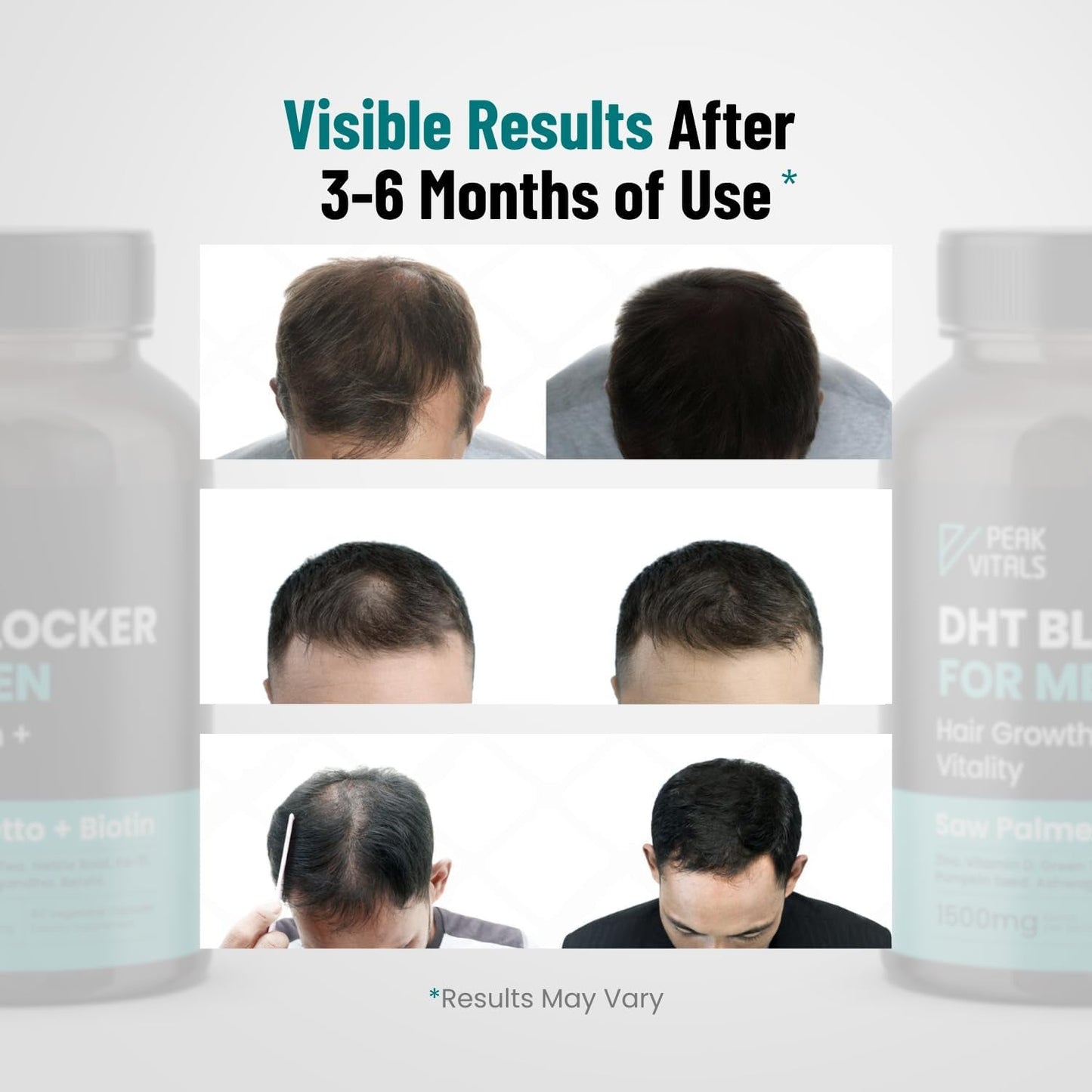 Natural Hair Growth Supplement for Men - 90 Capsules