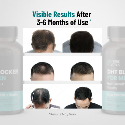 Natural Hair Growth Supplement for Men - 90 Capsules