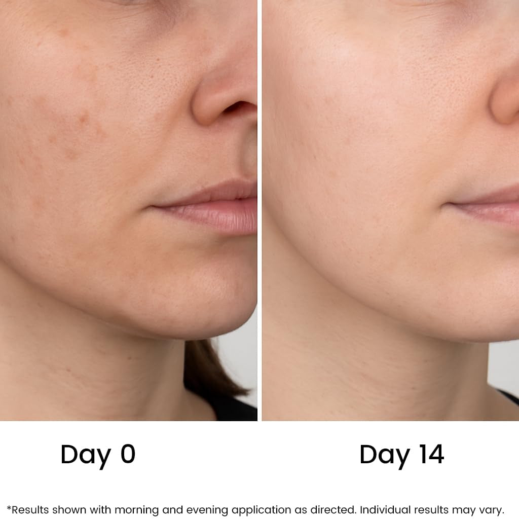 Natural Vitamin C Face Serum - Anti Aging Moisturizer