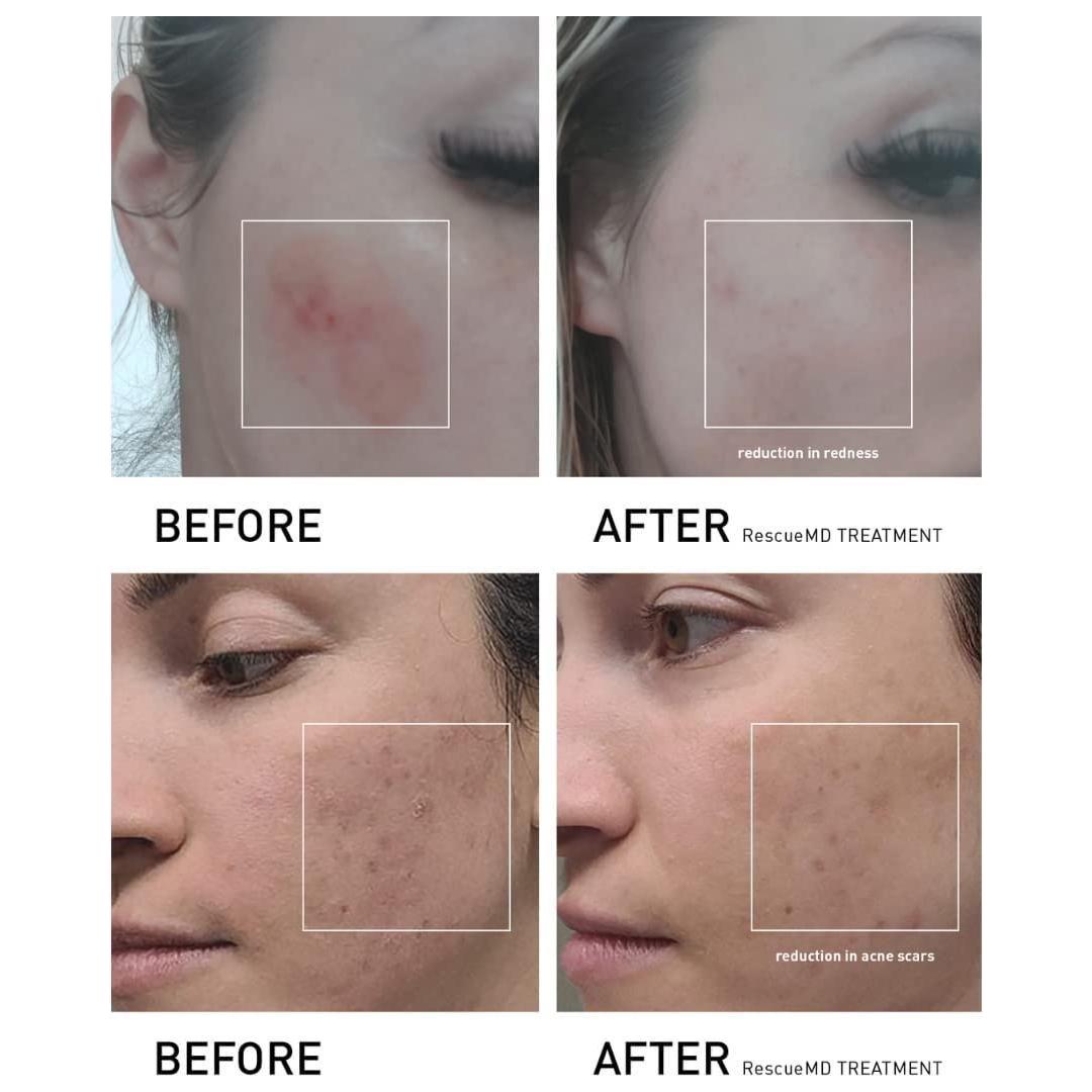 Intensive Skin Renewal Serum 15ml