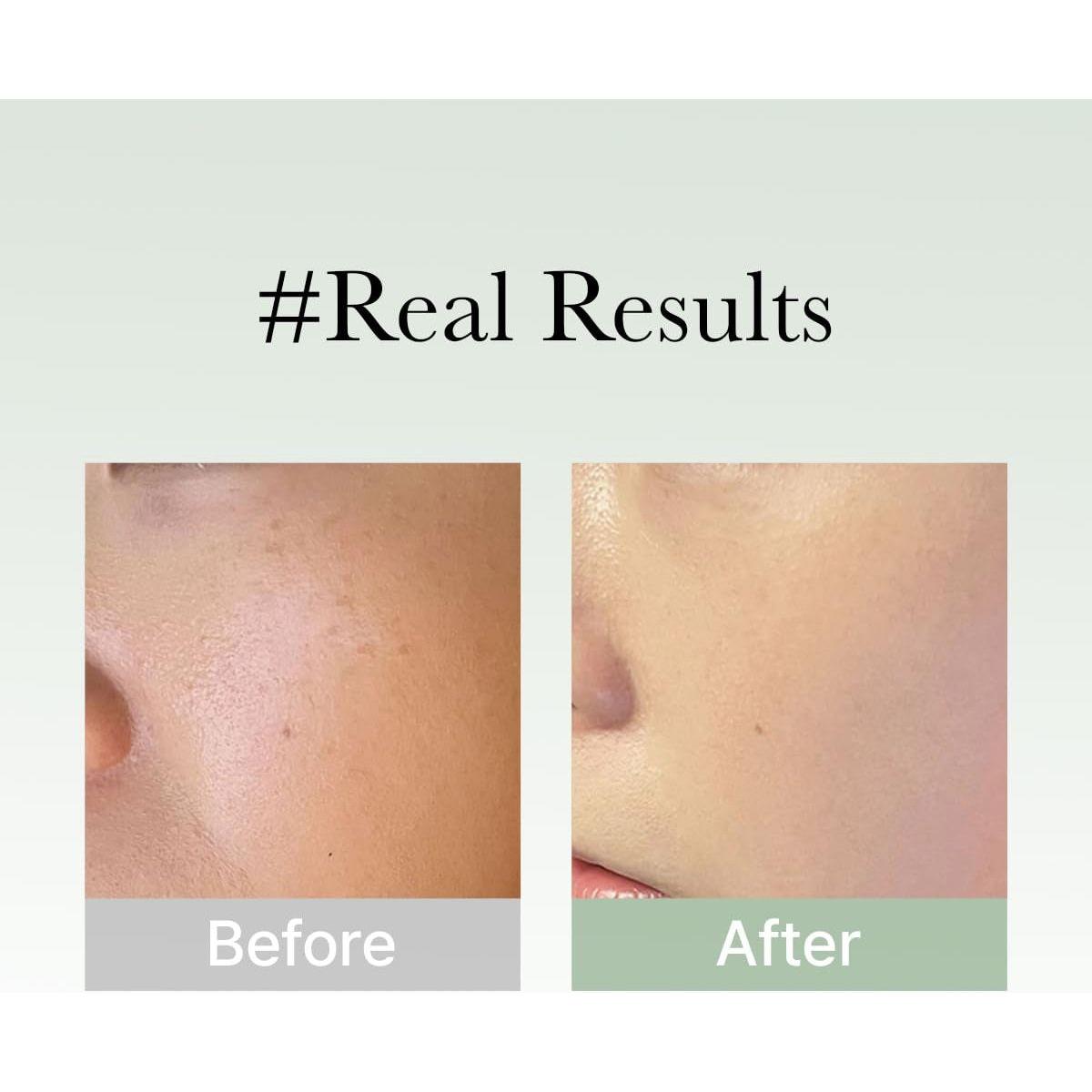 Nourishing Hyssop Face Serum 50ml - Moisturizing Glow