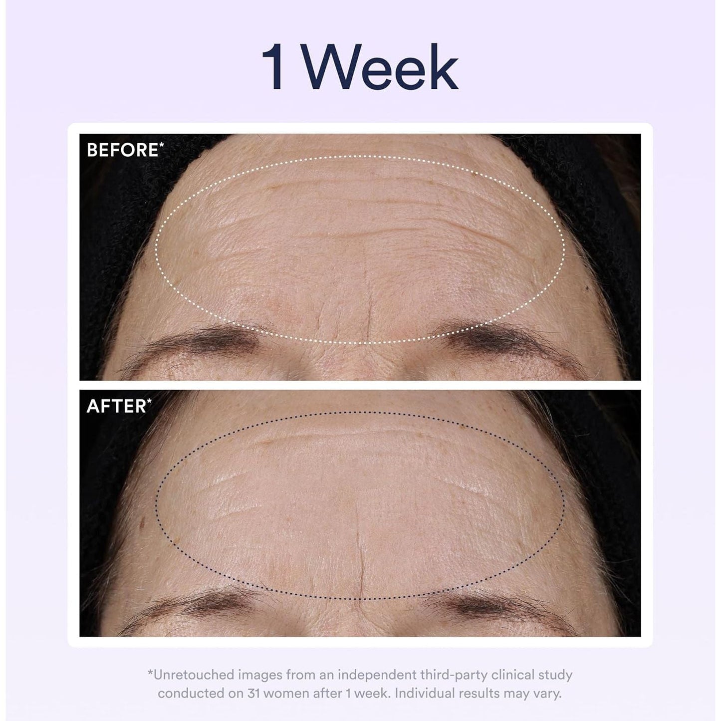 Anti Aging Night Serum with Retinol for Wrinkle Repair