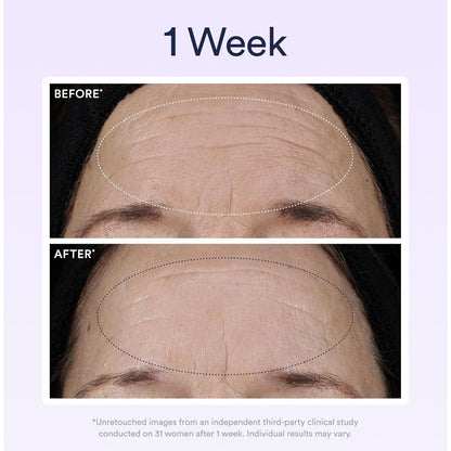 Anti Aging Night Serum with Retinol for Wrinkle Repair