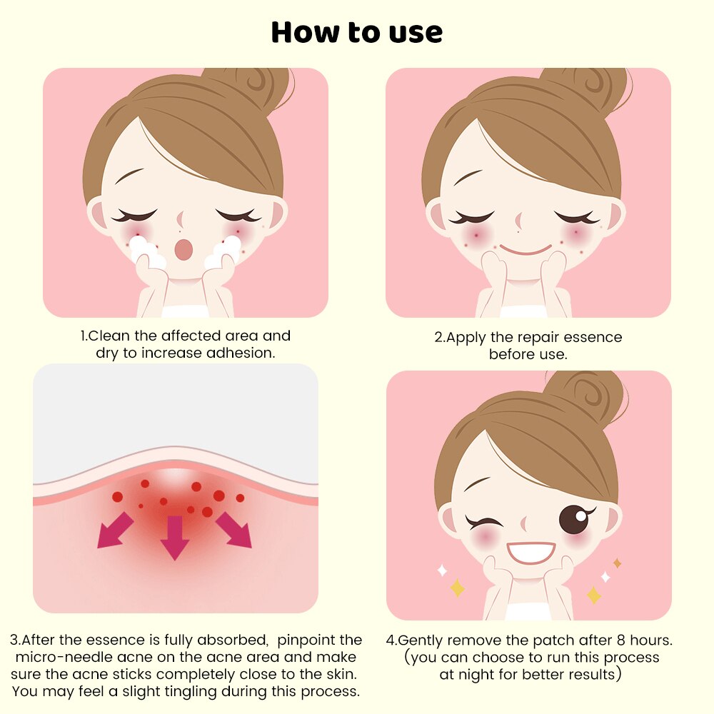 Acne Spot Treatment Patches 9 Pack - Quick Fix Skin Repair
