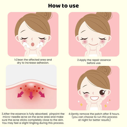 Acne Spot Treatment Patches 9 Pack - Quick Fix Skin Repair