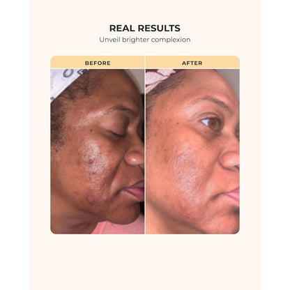 Natural Glow Skin Care Kit for Dark Skin Tones