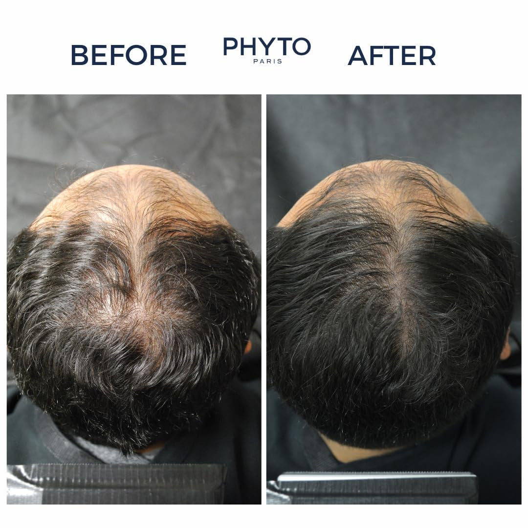 Thickening Hair Growth Serum for Men - 12 Vials