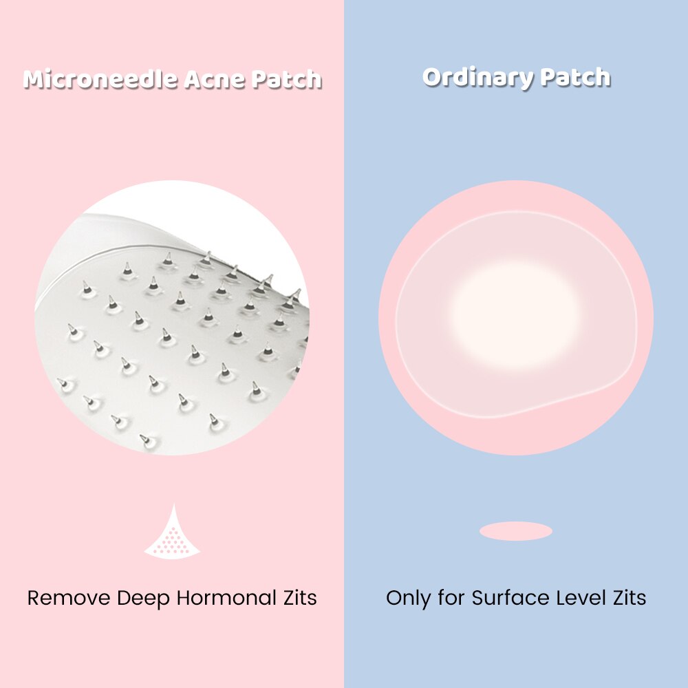Acne Spot Treatment Patches 9 Pack - Quick Fix Skin Repair