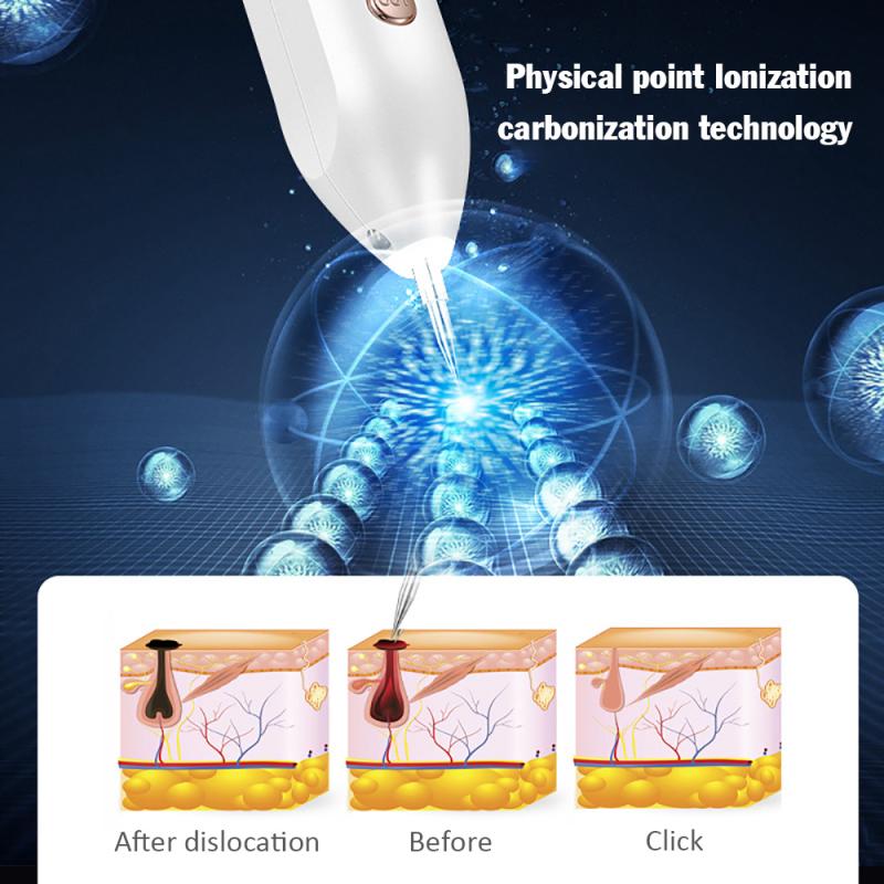 Professional Skin Tag Removal Laser Pen