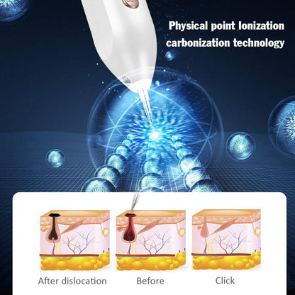 Professional Skin Tag Removal Laser Pen