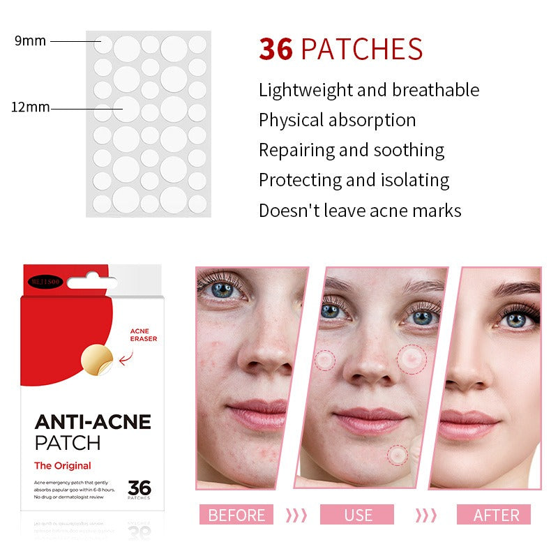 Clear Spot Treatment Pimple Patches (36 Count)