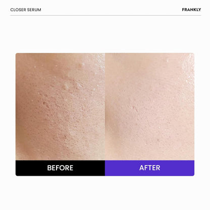 Effective Pore Minimizing Face Serum 100ml