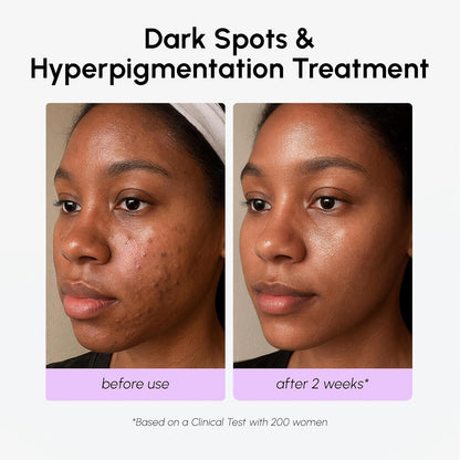 Glowing Skin Face Serum 30ml Evens Skin Tone