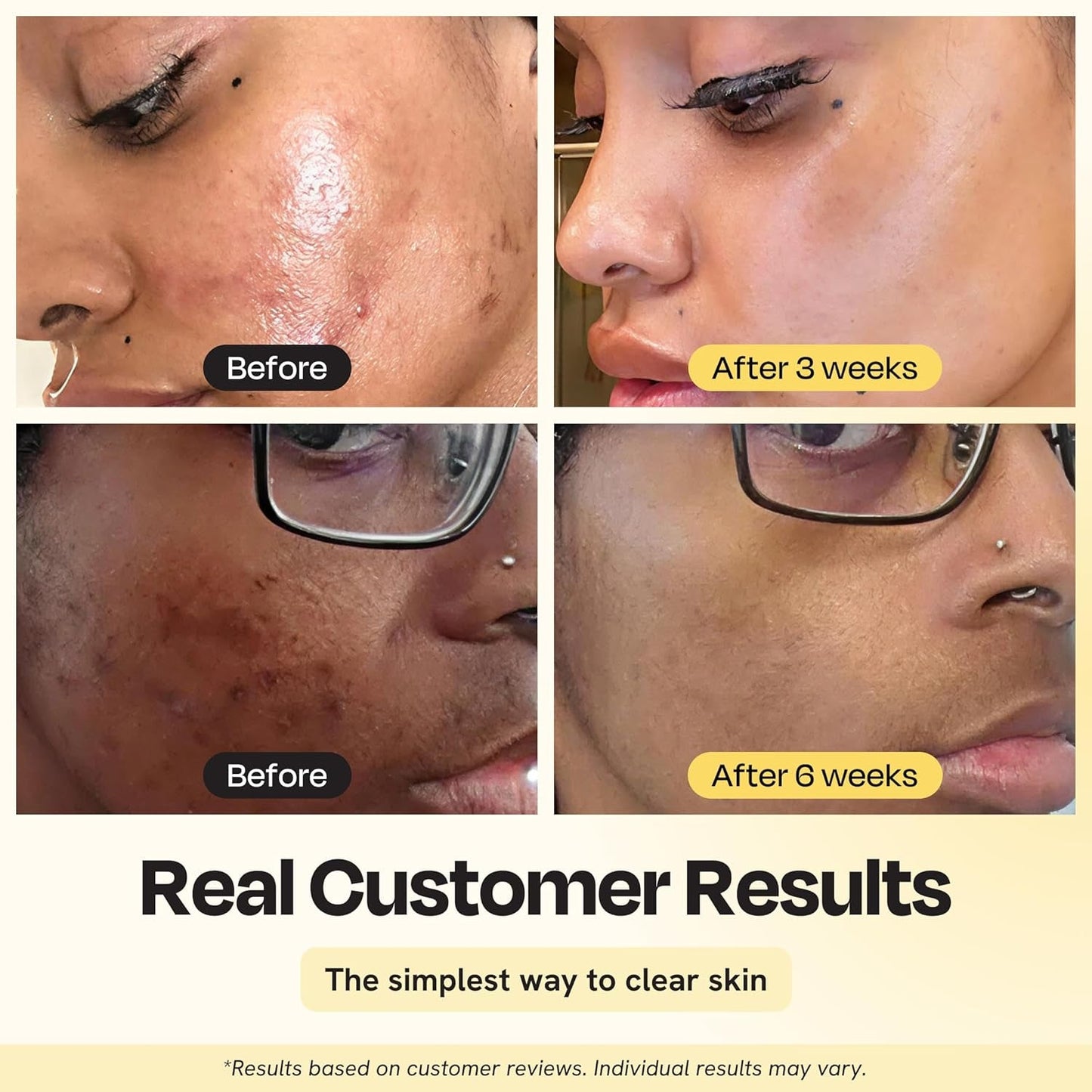 Natural Vitamin C Face Mask - 75ml | Brightening Skin Care