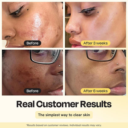Natural Vitamin C Face Mask - 75ml | Brightening Skin Care