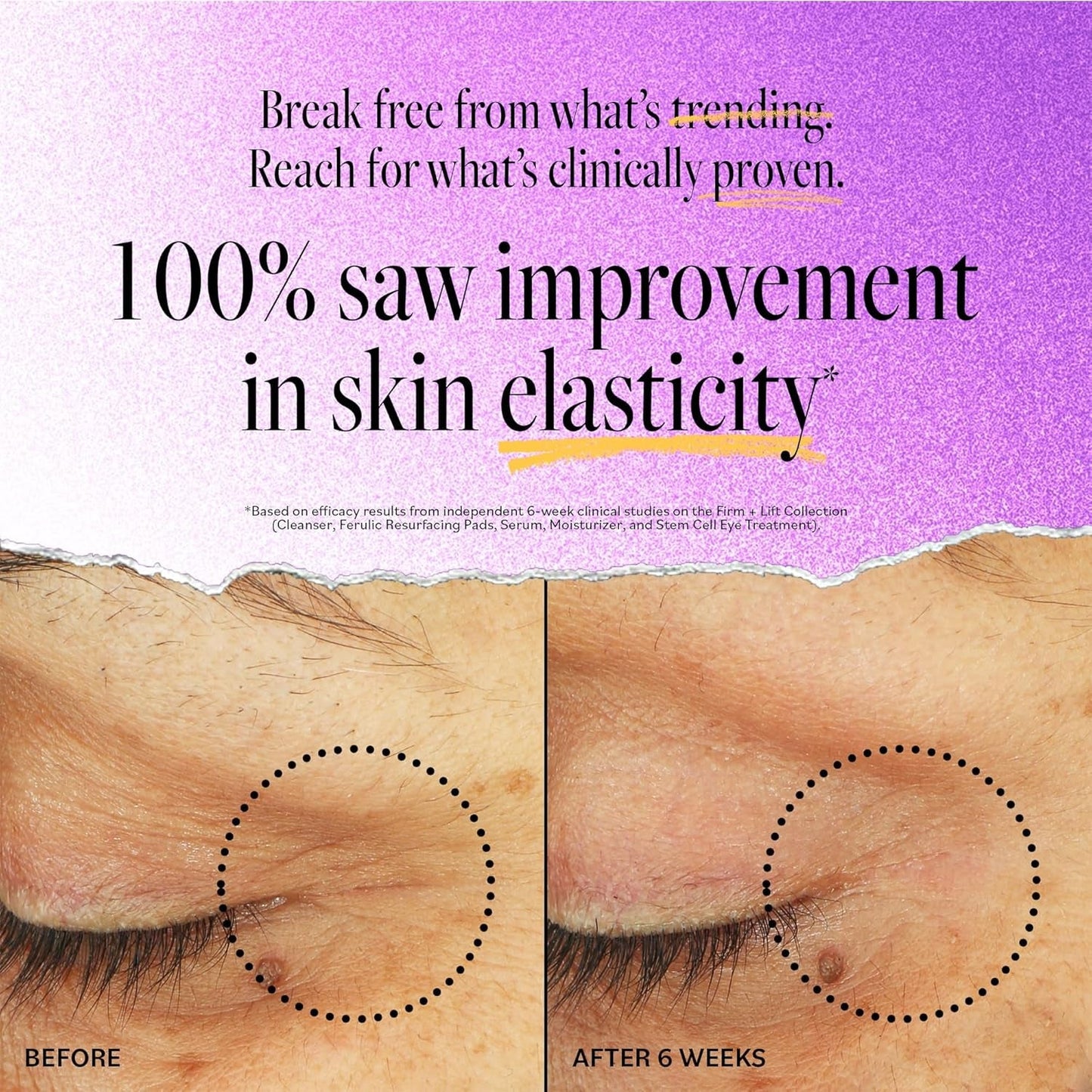 Anti Aging Eye Cream Firming Eye Lift Treatment