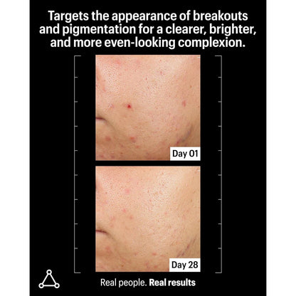 Powerful Azelaic Acid Skin Clarifying Serum 30ml
