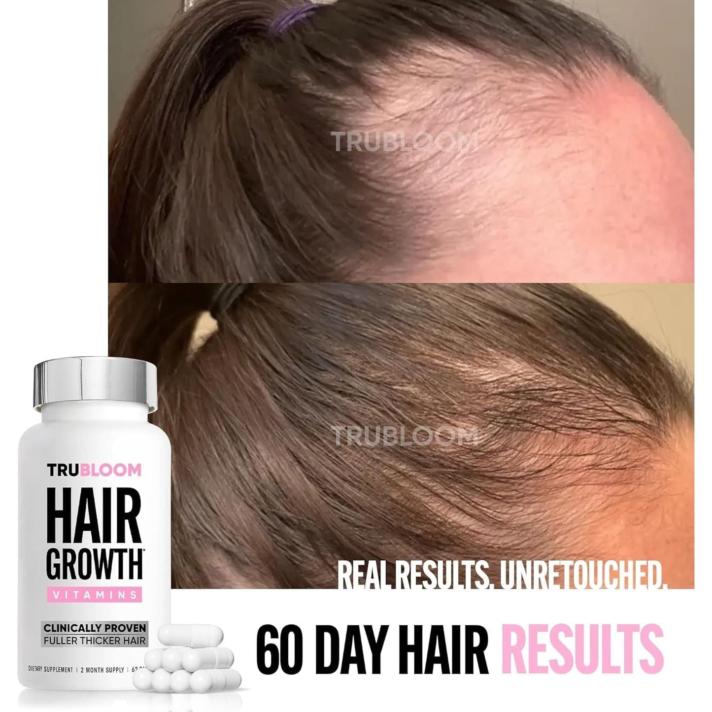 Natural Hair Growth Supplements for Thicker Hair